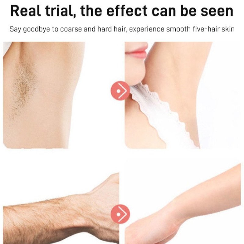 Depilador Yes - Imagen 4